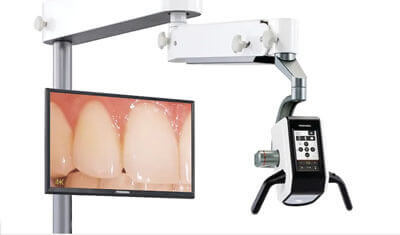 デジタルマイクロスコープ(手術用顕微鏡)