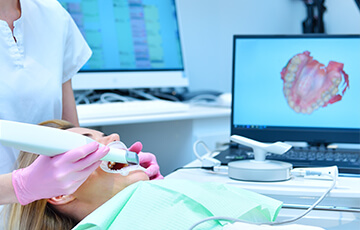 口腔内スキャナー