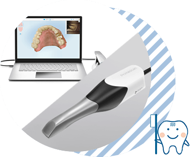 口腔内スキャナー